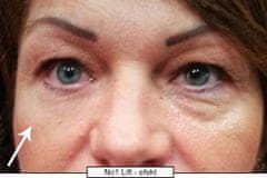 di ANGELO cosmetics Revolucionarna očesna krema št.1 Lift (Eye Cream) 15 ml